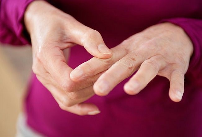 Причины и симптомы псориатического артрита